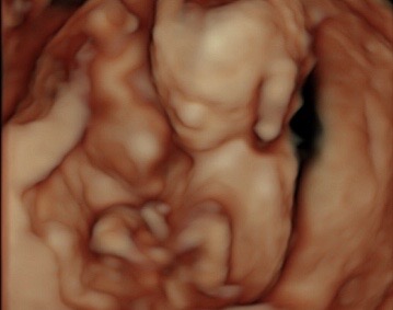 14 week ultrasound 3d/4d