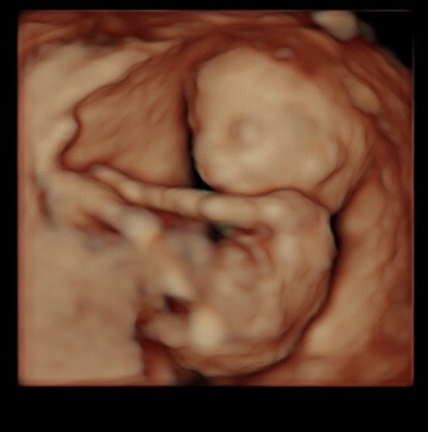 15 week sonogram