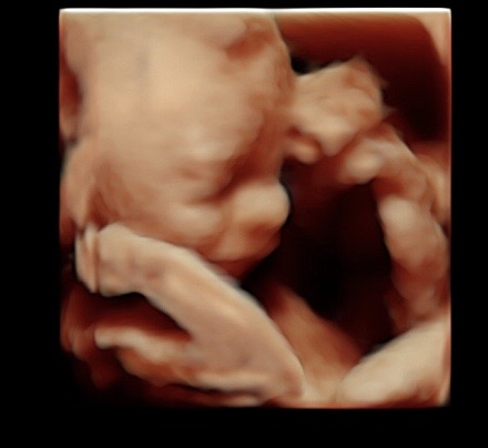 22 week ultrasound 3d/4d