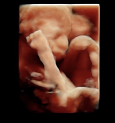 22 week ultrasound 3d