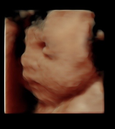 27 week ultrasound
