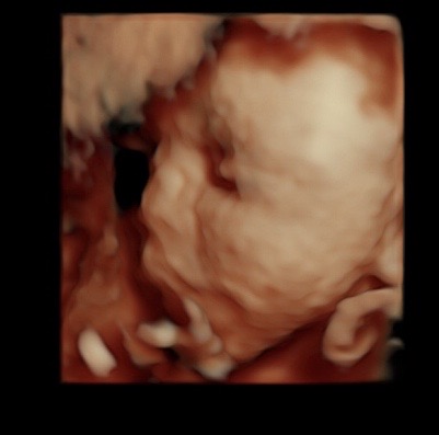 27 week ultrasound