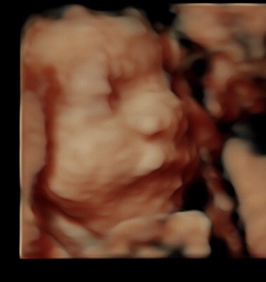 28 week ultrasound