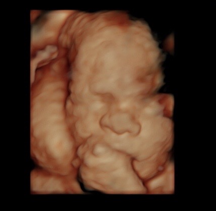 28 week ultrasound