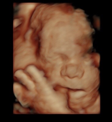 28 week sonogram