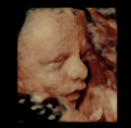 29 week ultrasound 3d/4d