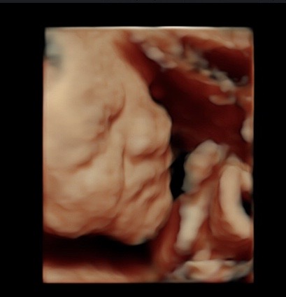 29 week ultrasound 3d/4d