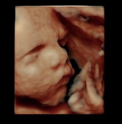 29 week ultrasound 3d/4d