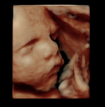 4d baby scan pictures