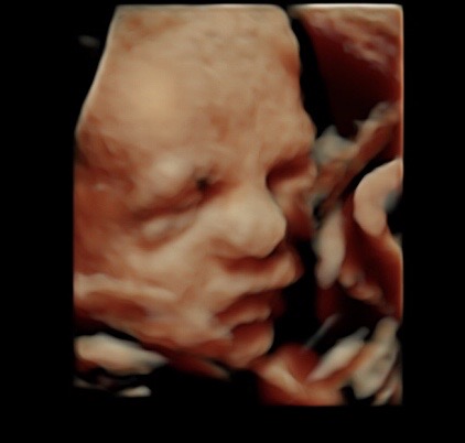 29 week ultrasound 3d/4d