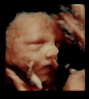 29 week ultrasound 3d/4d