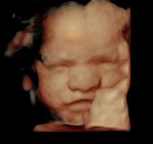 30 Week Ultrasound - Reveal 3D/4D Ultrasound Studio