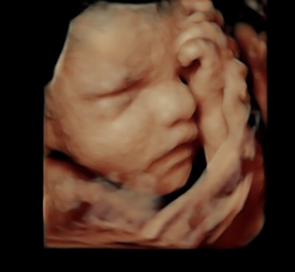 30 week sonogram