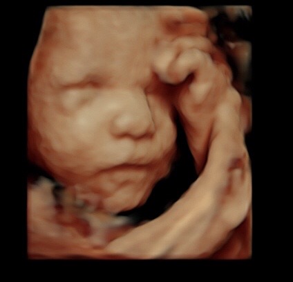 30 week ultrasound