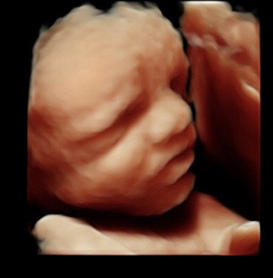 30 weeks 3d ultrasound