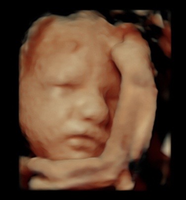 30 weeks 4d ultrasound