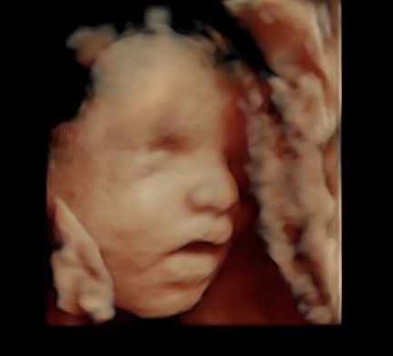 30 week ultrasound 3d/4d