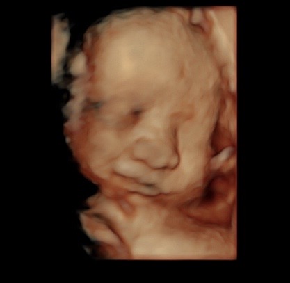 31 week ultrasound 3d/4d