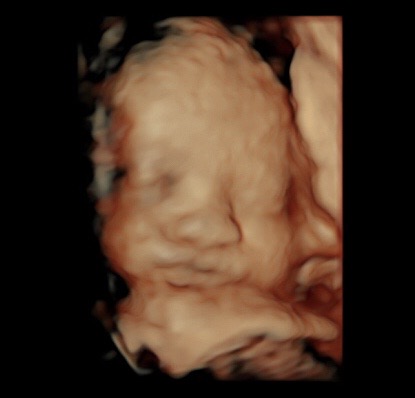 3d/4d ultrasound at 31 weeks