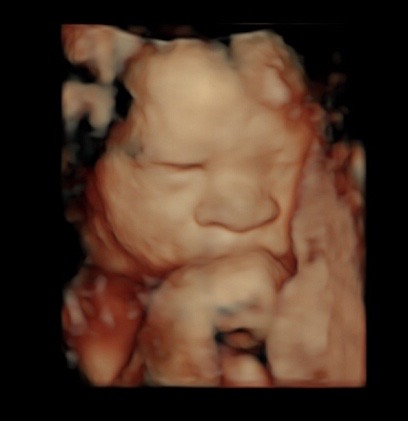 34 week ultrasound 3d/4d