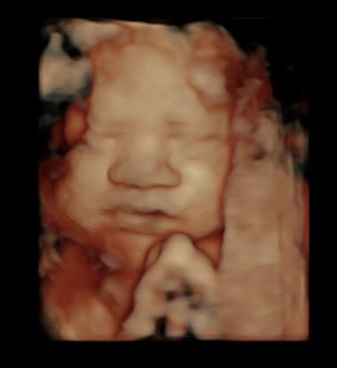 34 Week Ultrasound Reveal 3d 4d Ultrasound Studio