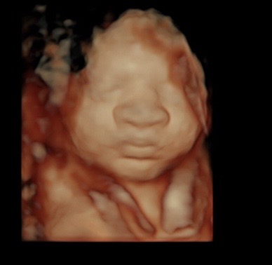 34 weeks 3d/4d ultrasound