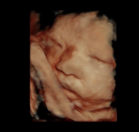 4d ultrasound pictures at 36 weeks