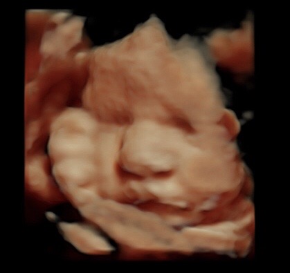 26 week 4d ultrasound