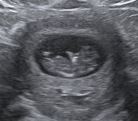 Expect 9 ultrasound week what to at 9 Weeks