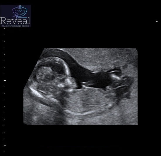 4d ultrasound pictures baby boy