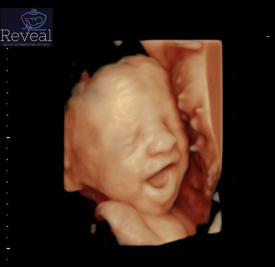 Color Ultrasound - Gilbert AZ