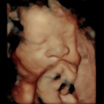 3d/4d ultrasound at 34 weeks