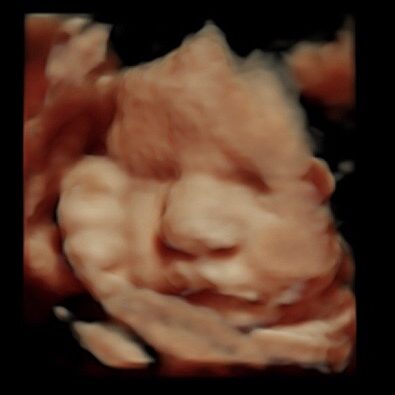36 week ultrasound 3d/4d