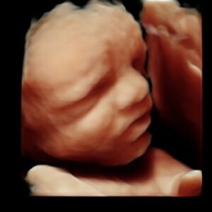 3d/4d ultrasound at 30 weeks